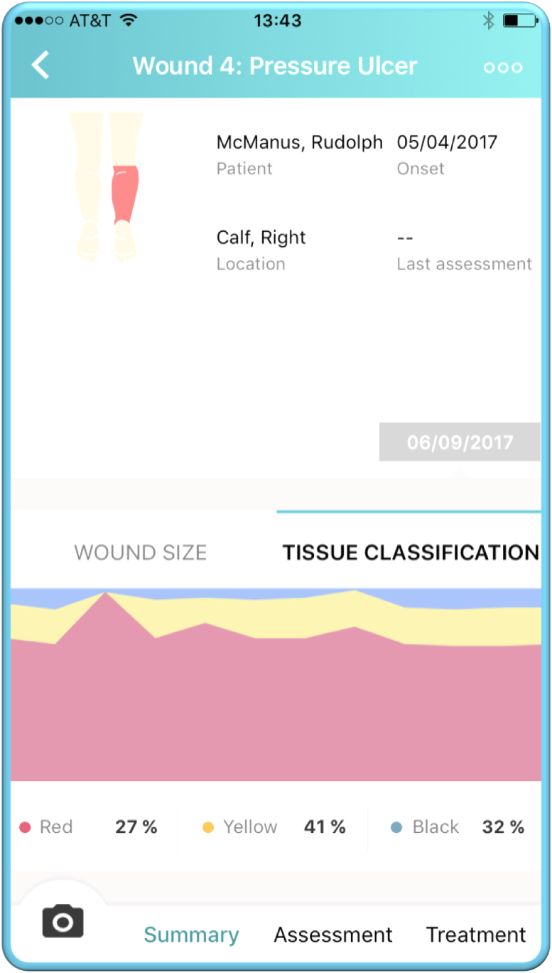 Wound Progression Charts And Gallery Images Ekare