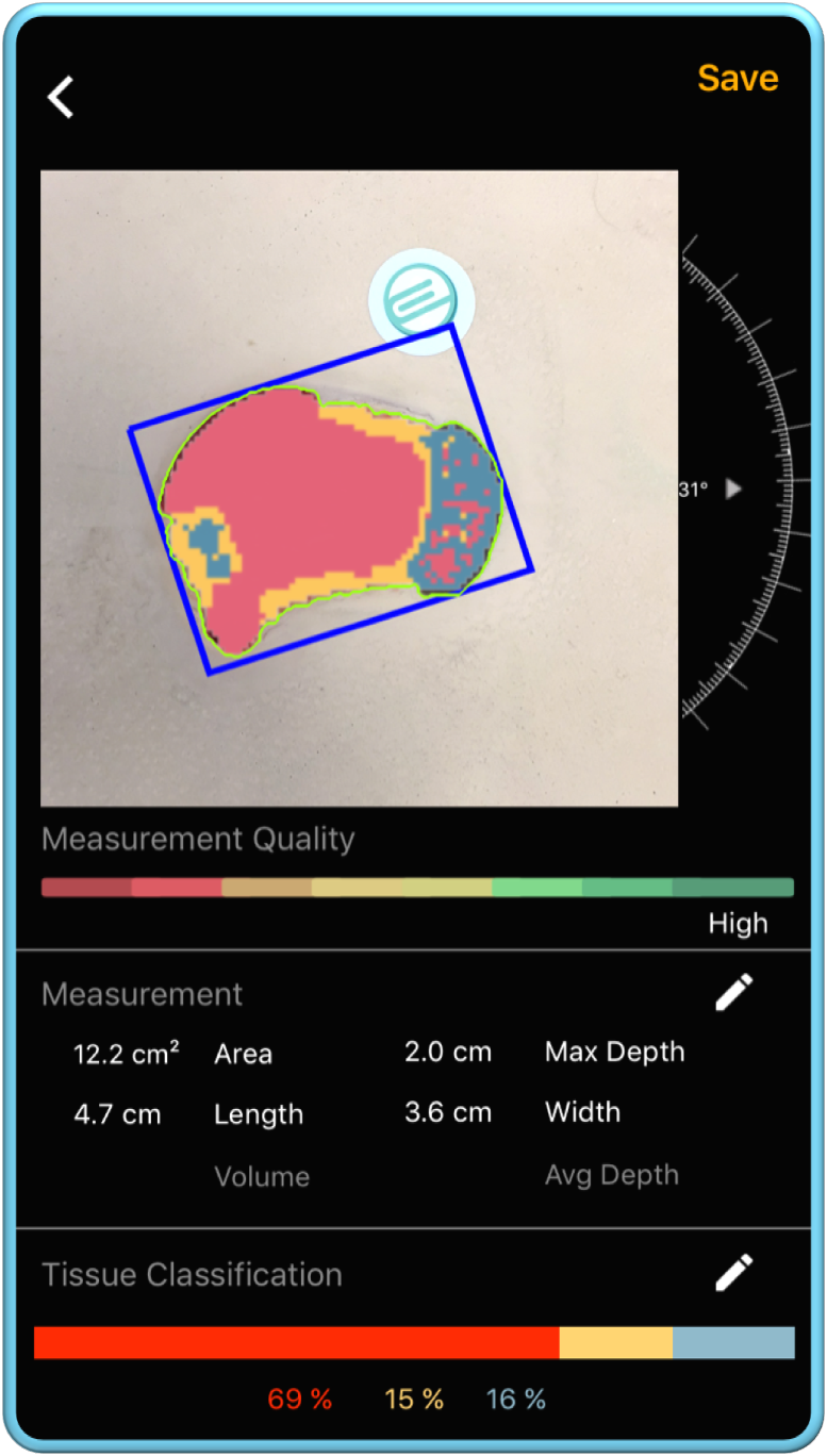 Wound_scan_4.png